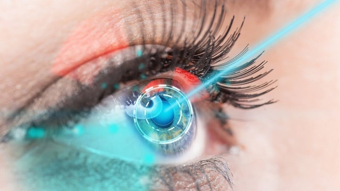 Restoration of sight through laser correction